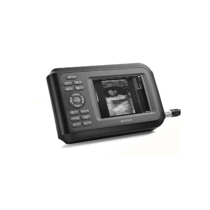 Scanner cu ultrasunete SONO-R