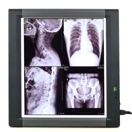 Negatoscop LED pentru filme cu raze X, panou unic MG01