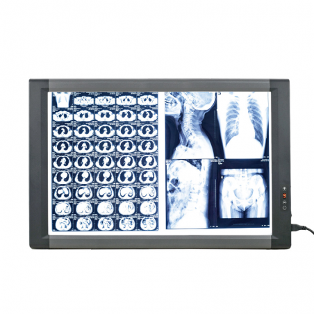 Negatoscop LED pentru filme cu raze X, două panouri MG02